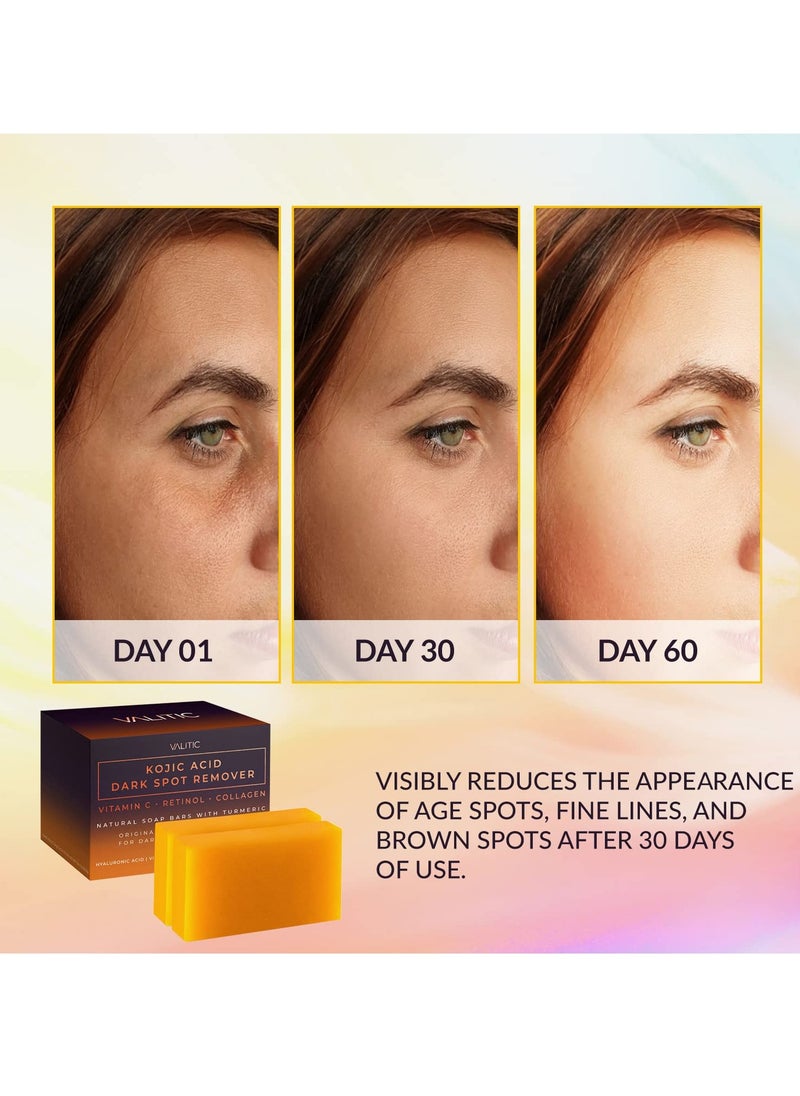 VALITIC VALITIC Kojic Acid Dark Spot Remover Soap Bars with Vitamin C, Retinol, Collagen, Turmeric - Original Japanese Complex Infused with Hyaluronic Acid, Vitamin E, Shea Butter, Castile Olive Oil (2 Pack)  - Image 3