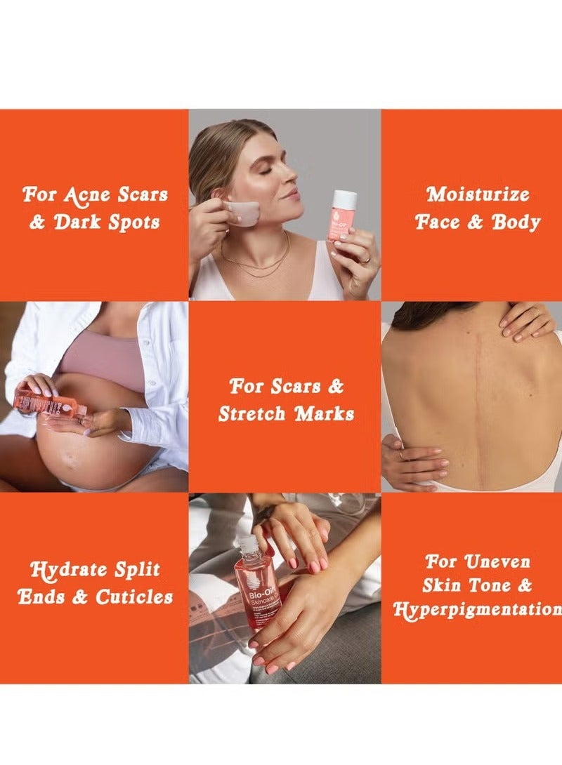 Bio-Oil Specialist Skincare Oil 200ml - Image 2