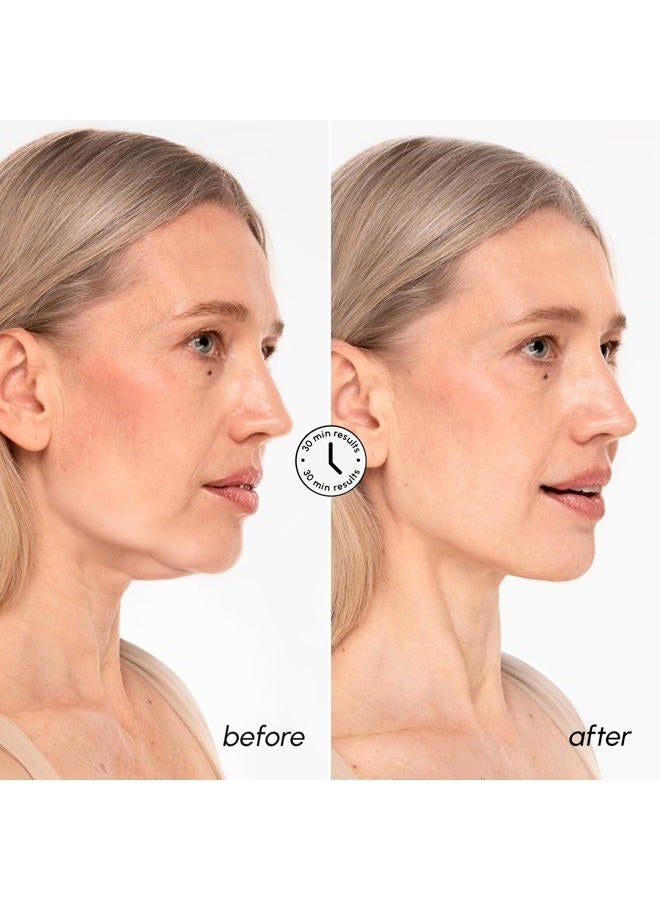 MAREE V Line Lifting Mask with 24K Gold – Deep Collagen Face Mask for Women – Jawline Shaper Mask with Retinol & Hyaluronic Acid – Neck Tightening & Firming - Double Chin Strap for Face Lift - Image 4