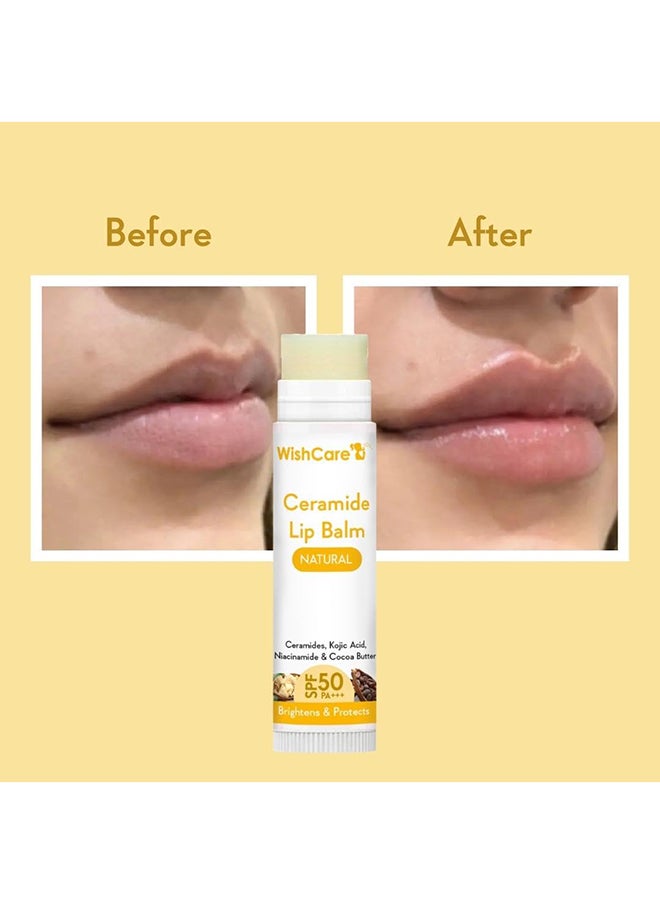 WishCare - Lip Balm with SPF 50 PA+++ - Brightening Lip Balm for Dark Lips with Kojic Acid & Niacinamide - SPF lip balm for Women & Men 5g - Image 1
