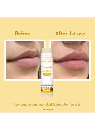 Ceramide Lip Balm with SPF 50 PA+++ | Brightening Lip Balm for Dark Lips | Kojic Acid & Niacinamide | For Men & Women | Natural & Untinted - view 4