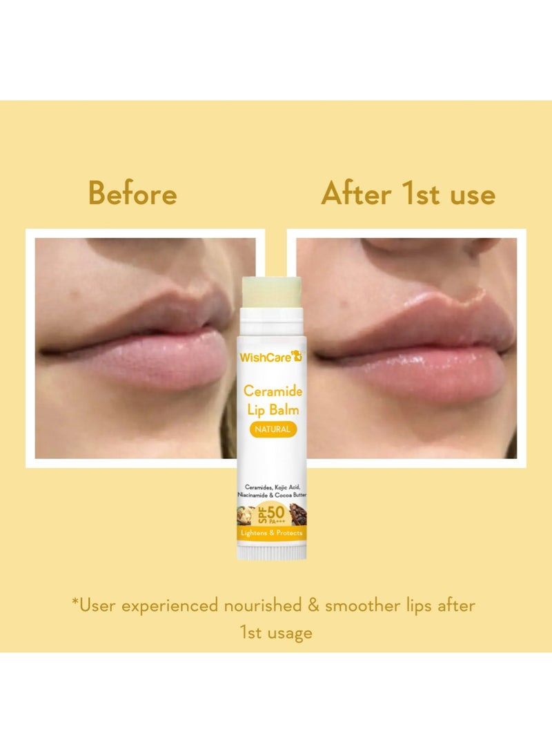 WishCare Ceramide Lip Balm with SPF 50 PA+++ | Brightening Lip Balm for Dark Lips | Kojic Acid & Niacinamide | For Men & Women | Natural & Untinted - Image 4