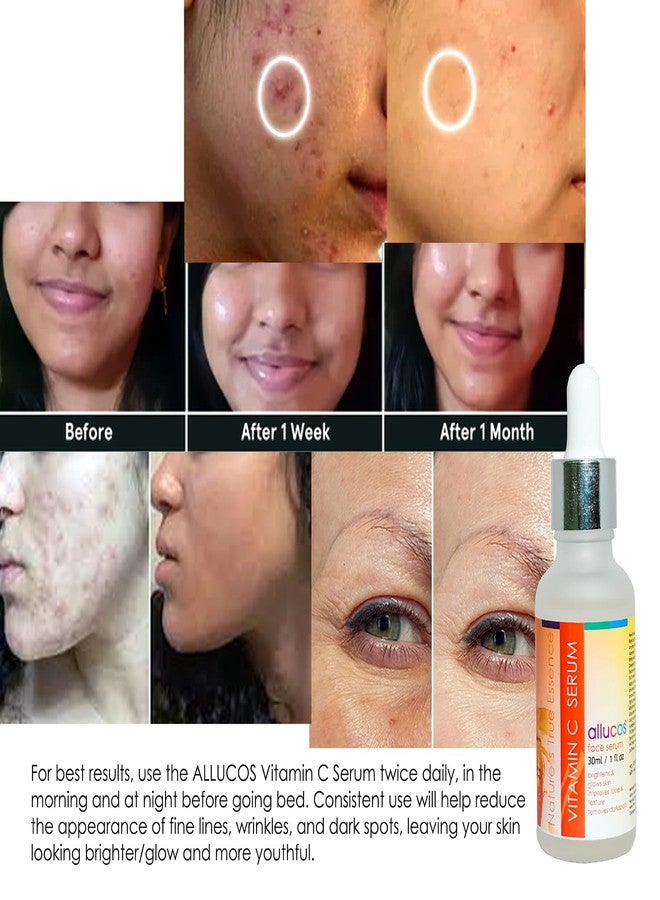 Allucos Vitamin C Serum - Reduces Dark Spots, Fine Lines | Glow Skin & Brightening | Reduces Pore & Fine Lines | Formula with Hydrates - 30 ML (Pack Of 1) - Image 3