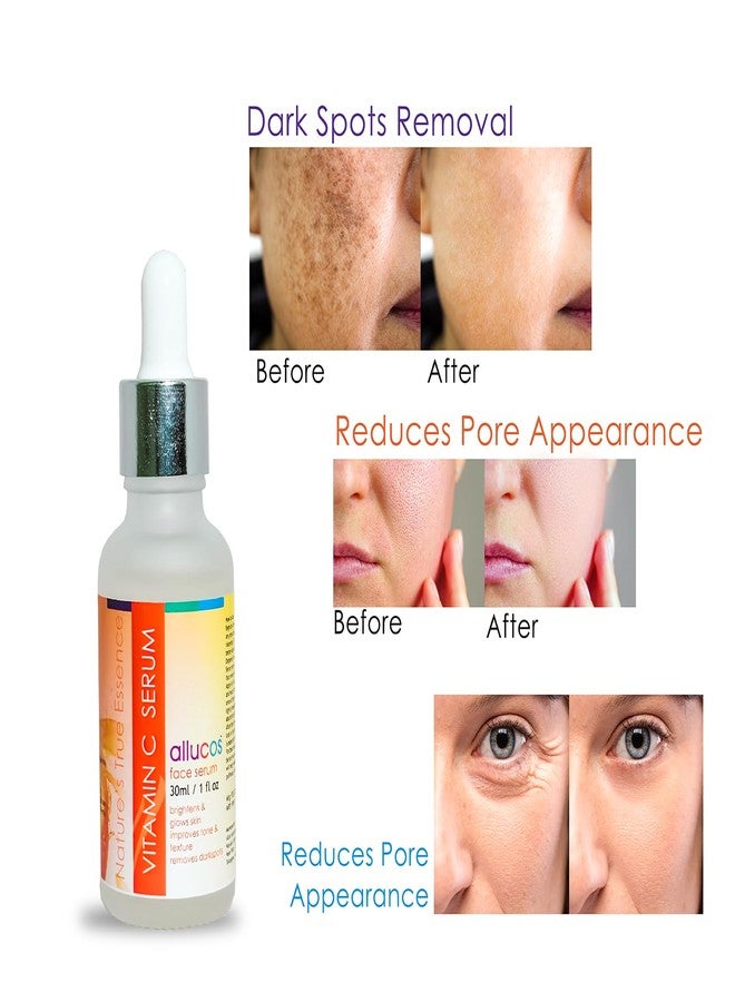 Allucos Vitamin C Serum - Reduces Dark Spots, Fine Lines | Glow Skin & Brightening | Reduces Pore & Fine Lines | Formula with Hydrates - 30 ML (Pack Of 1) - Image 2
