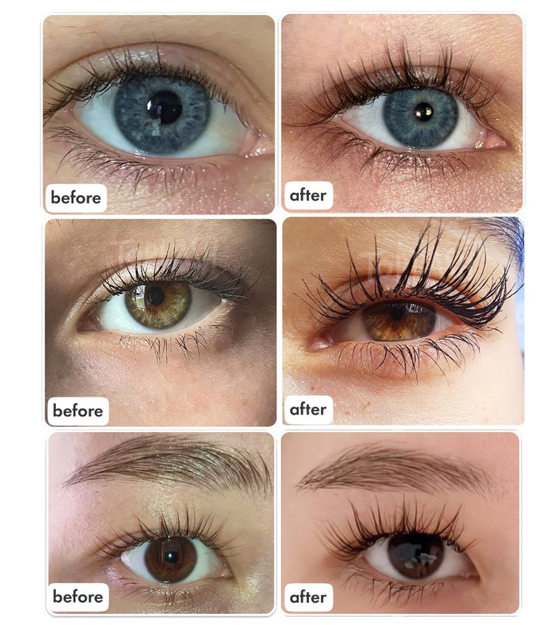 TOPLASH XL Lash and Brow Booster, Growth Serum with Eyelash and Eyebrow Enhancer, Promotes Stronger, Thicker, Healthier Lashes with Botanicals and Peptides - 0,2 Fl Oz(6 ml) - Image 2