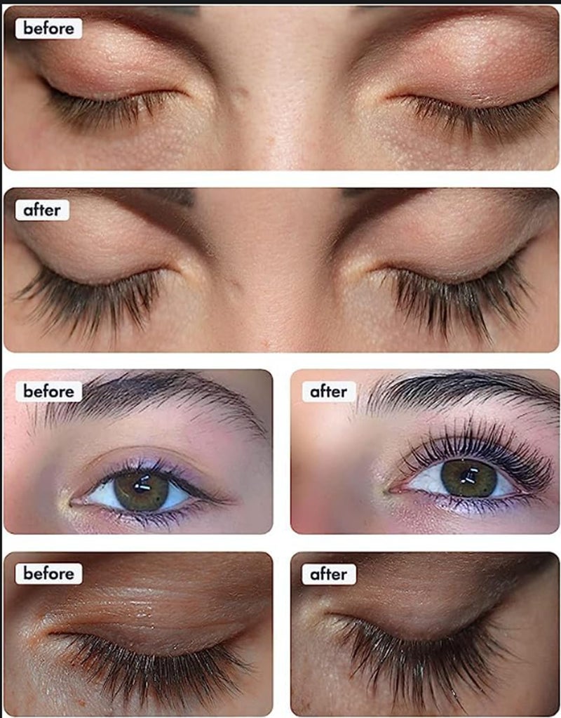 TOPLASH XL Lash and Brow Booster, Growth Serum with Eyelash and Eyebrow Enhancer, Promotes Stronger, Thicker, Healthier Lashes with Botanicals and Peptides - 0,2 Fl Oz(6 ml) - Image 4