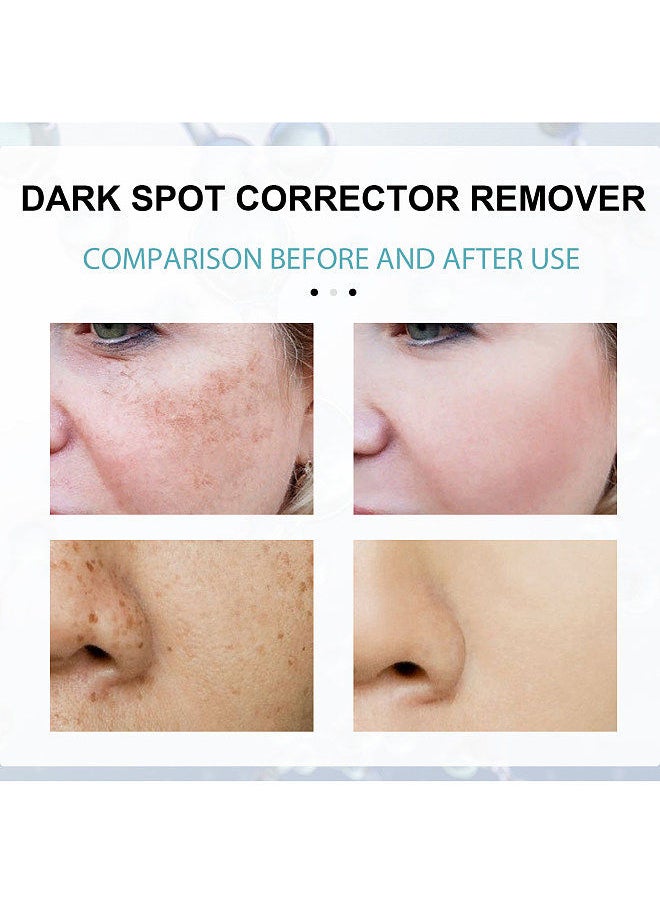 EELHOE EELHOE 30g Dark Spot Corrector Remover Cream Whitening Moisturizing Bighten Complexion Improving Skin Barrier  - Image 4