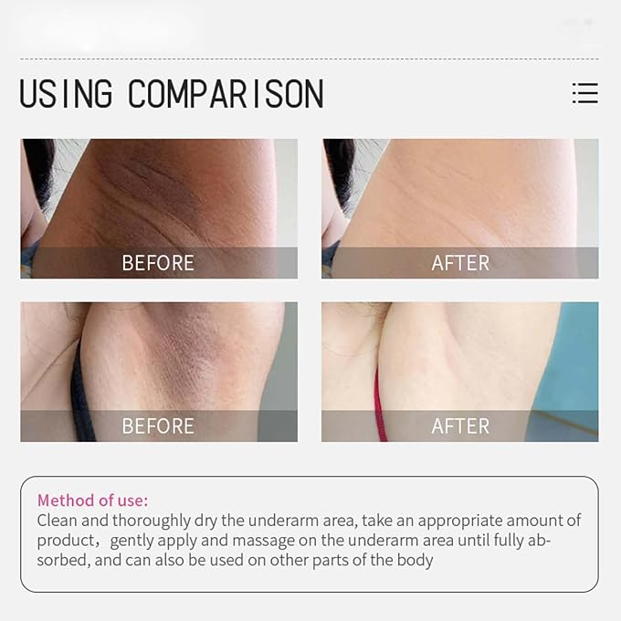 YOOJ 2 Pack 50ml2 Kojic Acid & Collagen Cream, Skin Lightening Lotion for Dark Spots, Dark Underarms Treatment, Non-Greasy Care for Armpits, Knees, Elbows & Bikini Area - Image 3