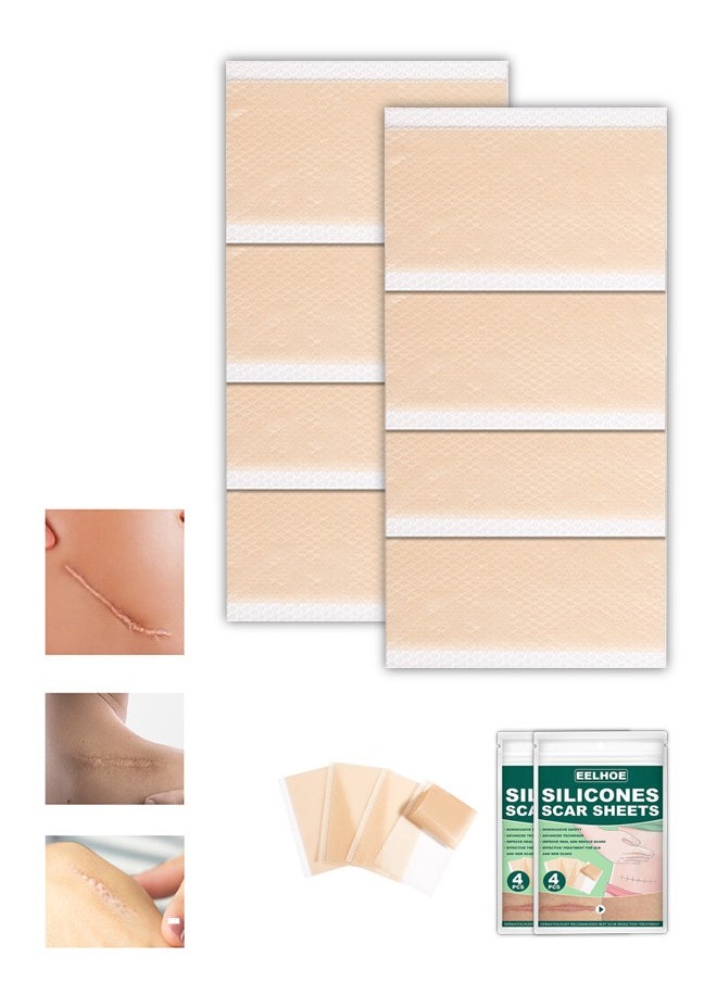 EELHOE - 8 Pcs Silicone Scar Sheets Scar Tape, Effective Scar Removal Strips, Repair Patch for Cesarean Section Burn Scars and Other Scars Left (Color) - Image 1