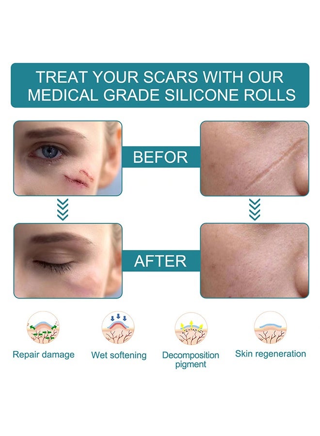 DUNISO Silicone Scar Tape,Fade Scar Sticker，Multi-Purpose Silicone Scar Sheets，Reusable，waterproof ，for Scar Repair Skin Regeneration，4cm x1.5m - Image 4