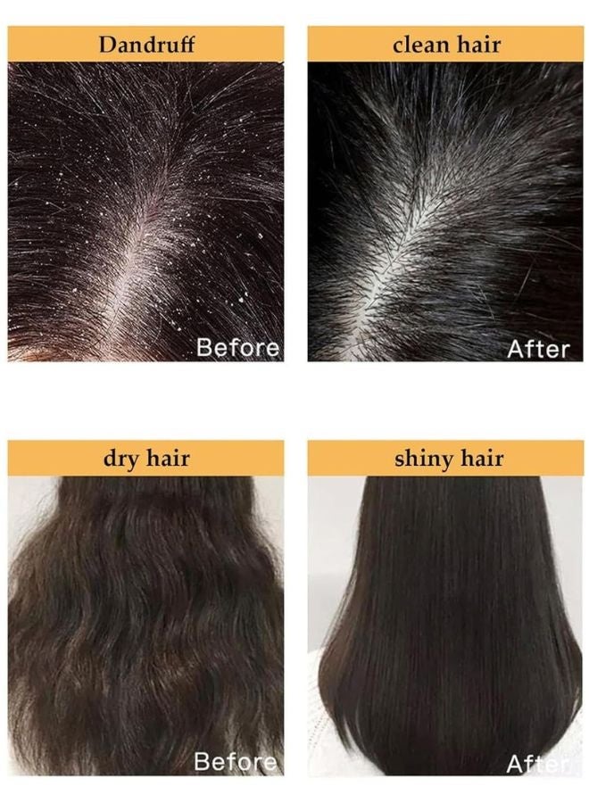 Diyating Sakura Japanese Shampoo for Hair Loss and Hair Growth, Thick & Shiny Hair, With Conditioner Effect, 300ml - Image 4