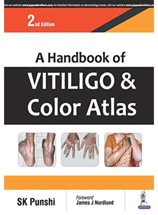 A Handbook Of Vitiligo & Color Atlas by Punshi, S. K. Paperback