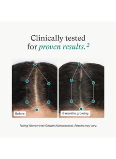 NUTRAFOL Women's Hair Growth Supplements and Hair Serum, Ages 18-44, Clinically Tested for Visible Thickness and Strength - 1 Month Supply, 1.7 Fl Oz Bottle  - Image 4