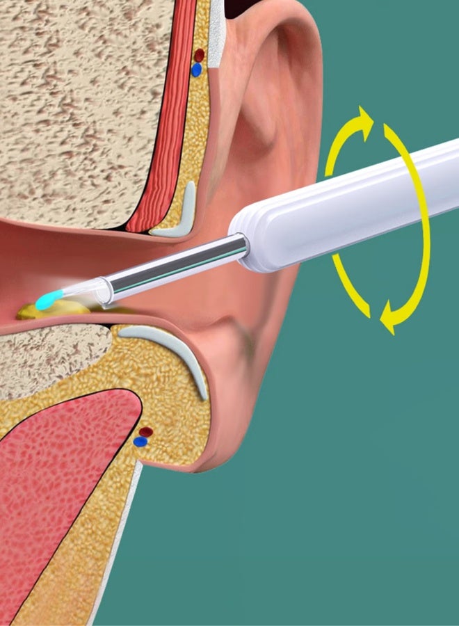 مزيل شمع الأذن بملعقة الأذن المرئية لهواتف iPhone وiPad وهواتف Android، منظار واي فاي لاسلكي HD مزيل شمع الأذن، مزيل شمع الأذن المرئي Wi-Fi (مجموعة من 8 قطع من أطراف الملعقة متضمنة) - Image 2