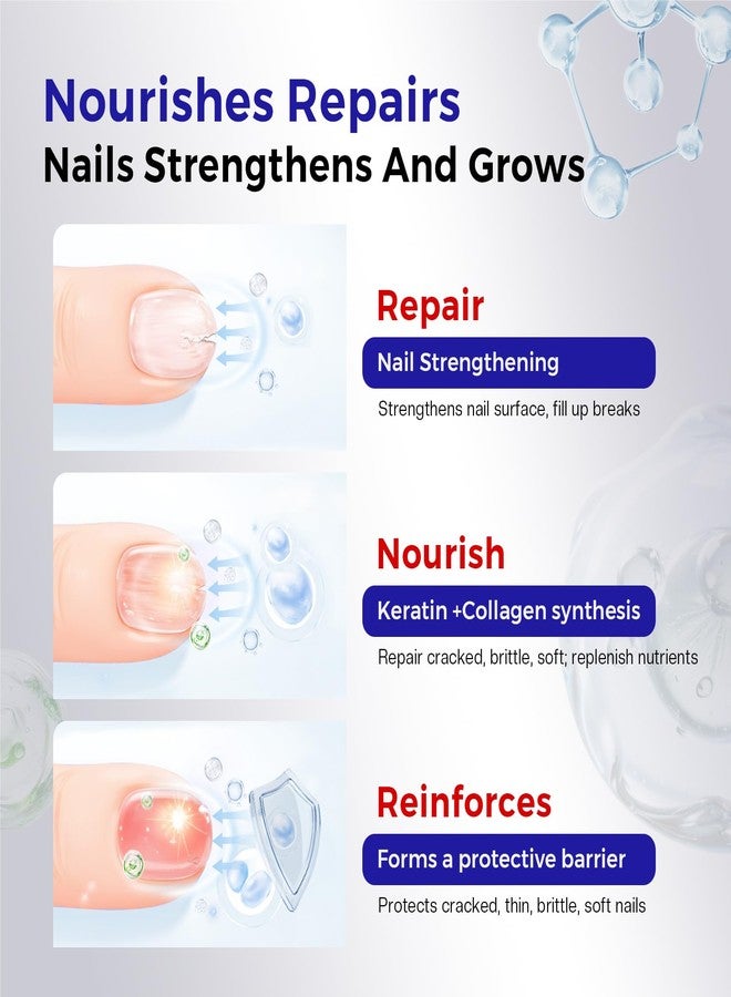 Morovan Nail Strengthener and Growth: Clear Nail Polish Hardener for Damaged Nails Treatment Natural Keratin Repair Ridge Filler Prevents Discoloration Crack Thin Essential Manicure Nail Care Women - Image 3