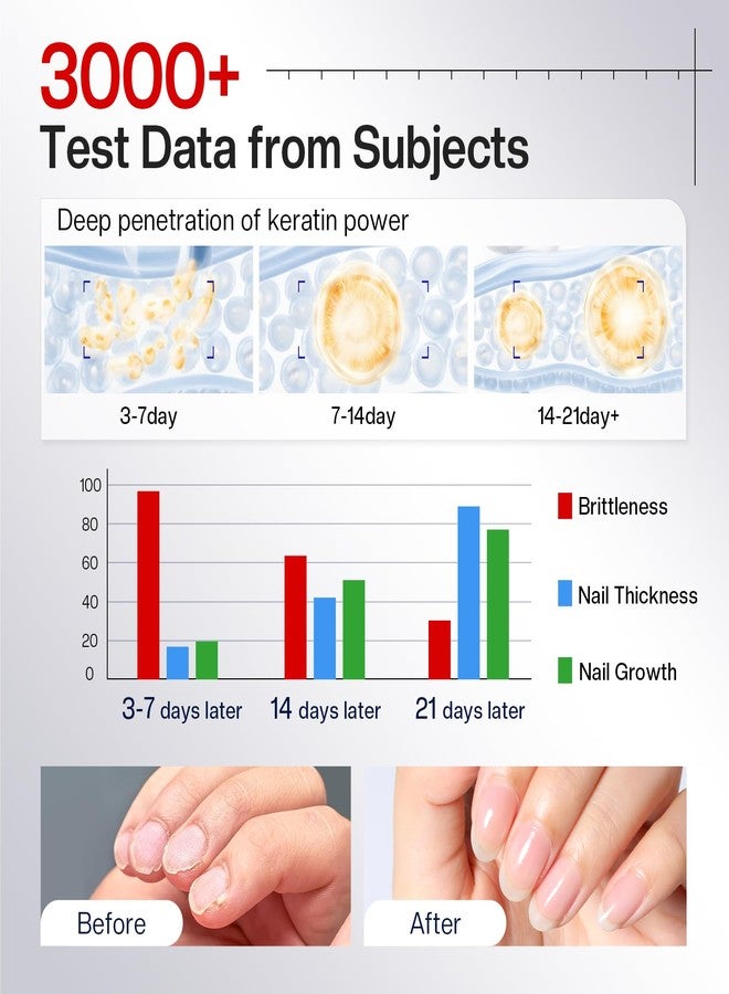 Morovan Nail Strengthener and Growth: Clear Nail Polish Hardener for Damaged Nails Treatment Natural Keratin Repair Ridge Filler Prevents Discoloration Crack Thin Essential Manicure Nail Care Women - Image 5