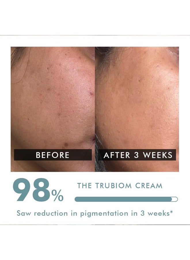 CONSCIOUS CHEMIST - ® Pigmentation Removal Cream | 50G | Kojic Acid Cream, Azelaic Acid Cream, Tranexamic Acid & Niacinamide, Anti-Pigmentation, Reduce Dark Spots, Gel Cream, All Skin Types - Trubiom - Image 1