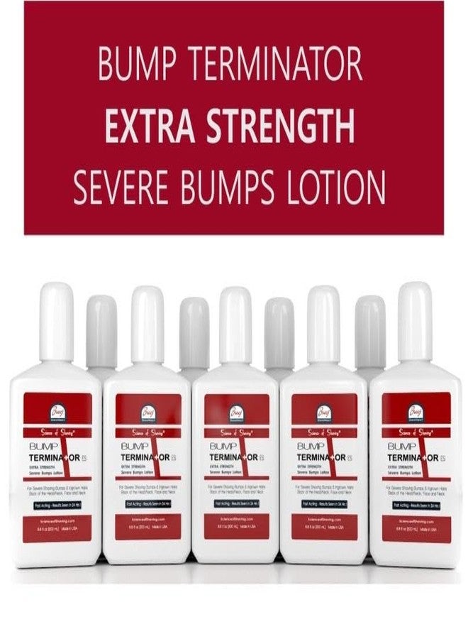 BREEJ BUMP TERMINATOR EXTRA STRENGTH Severe Bumps Treatment | Razor Bumps And Ingrown Hair Treatment | Bikini Bumps | Back of Head Bumps And Ingrown Hair Treatment, 6.8 oz (Pack of 1) - Image 4