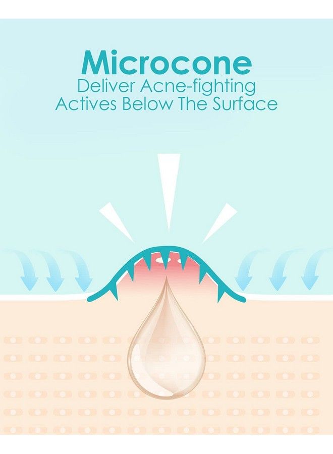 +1HEROLABS Herolabs Microcrystal Acne Healing Patch (18 Patches) Hyaluronate Salicylic Acid Vitamin C Pimple Patch For Deep Early Stage And Hidden Pimples (18 Count (Pack Of 1))  - Image 5