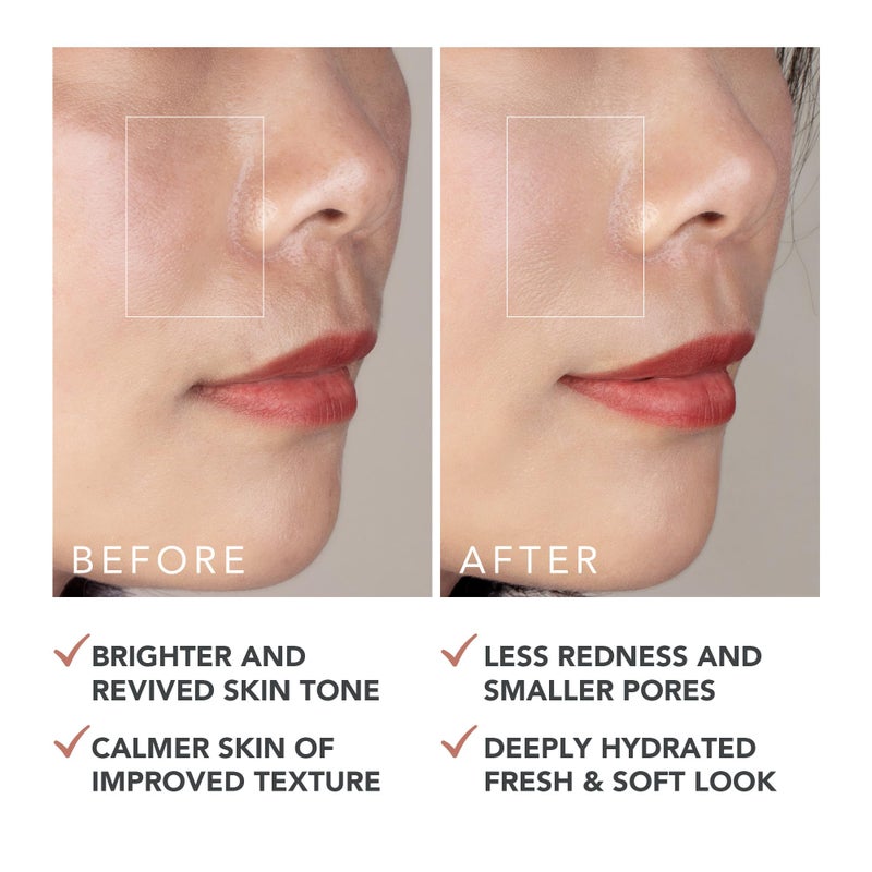 FOREO SUPERCHARGED Barrier Restoring Essence Mist, 3.7 fl oz - Collagen Boosting Spray Moisturiser - Collagen Peptides, Niacinamide, Centella Asiatica, Panthenol - Face Mist For All Skin Types - Image 5