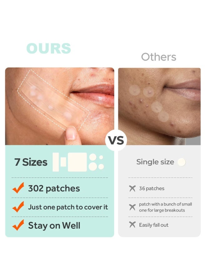 اكني باتش 302 قطعة لاصقات كبيرة للبثور للوجه، 7 أحجام لاصقات حب الشباب، لاصقات هيدروكوليد كبيرة للجسم، الذقن، الجبهة، الصدر، الظهر، تعالج ظهور البثور، تخفف حب الشباب والرؤوس السوداء، لطيفة وغير مهيجة. - Image 4