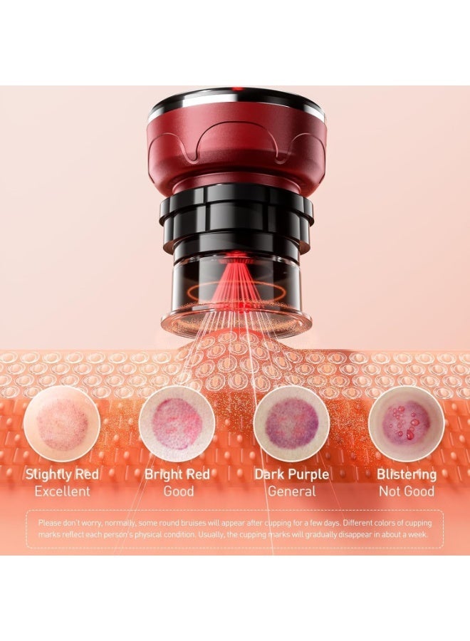 YOUWE7 Smart Cupping Therapy Set - Cellulite Massager with 8 Massage Cups, Portable Electric Device for Enhanced Blood Circulation, Reduced Cellulite, and Muscle Soreness Relief（Red） - Image 4