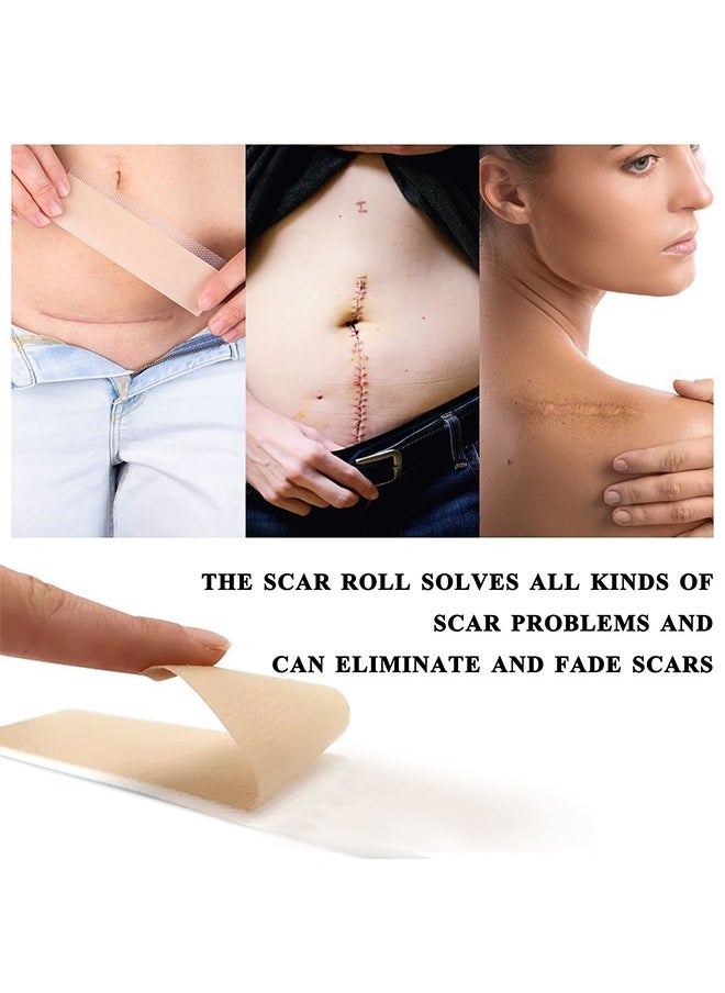 Elaimei - Silicone Scar Sheets 4cm*1.5m,Soft Silicone Gel Scar Tape Painless Silicone Tape Roll Effective Silicone Scar Removal Strips Sheets for C-Section & Keloid Surgery, Burn, Acne - Image 1