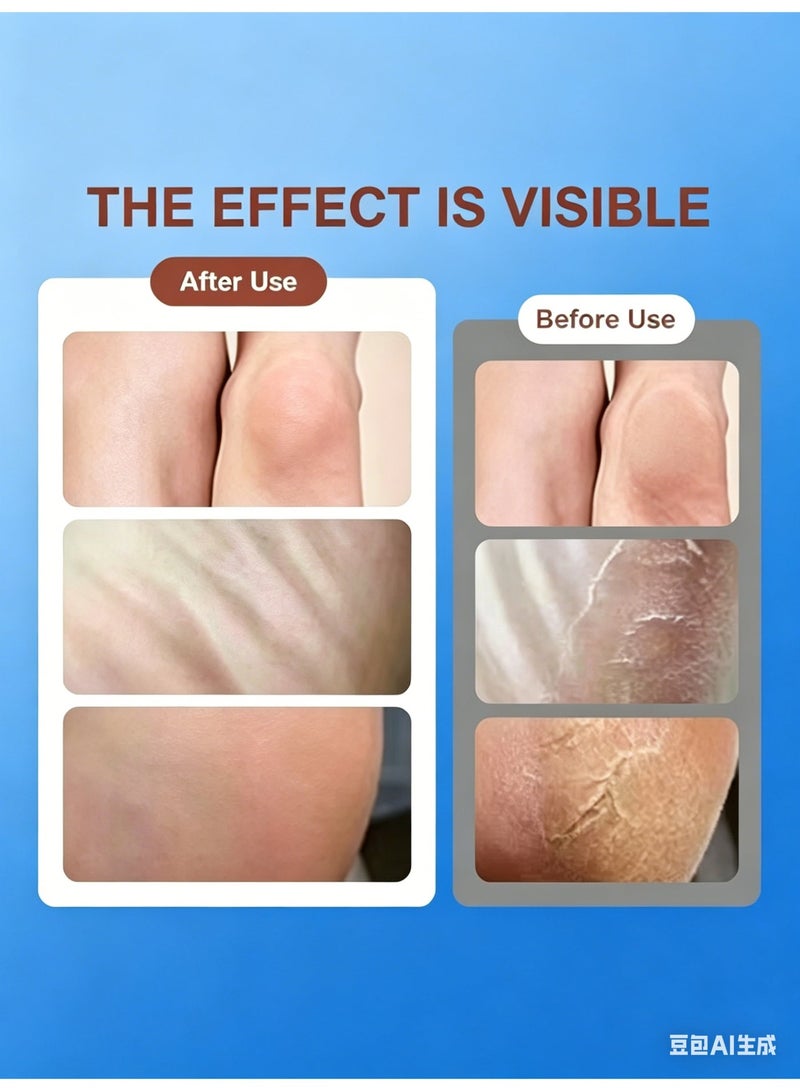 Electric Callus Remover File callus Remover for Feet  Pdicure Tool Foot care Foot File- 2 Rollers Included, IPX7 Fully Waterproof - Image 5