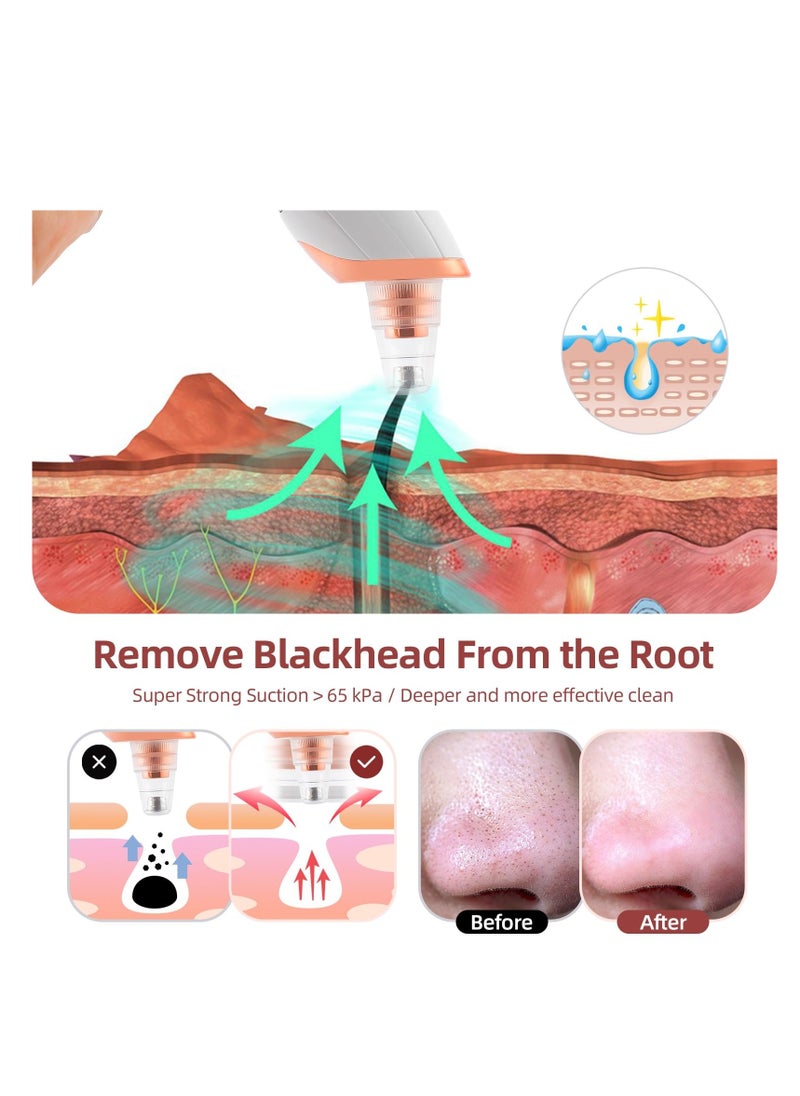 SYOSI Pore Vacuum Blackhead Remover Vacuum Electric Pore Cleaner with 5 Probes & 3 Level and LED Display Blackhead Extractor for Face and Nose Includes Blackhead Remover Tool Kit  - Image 2