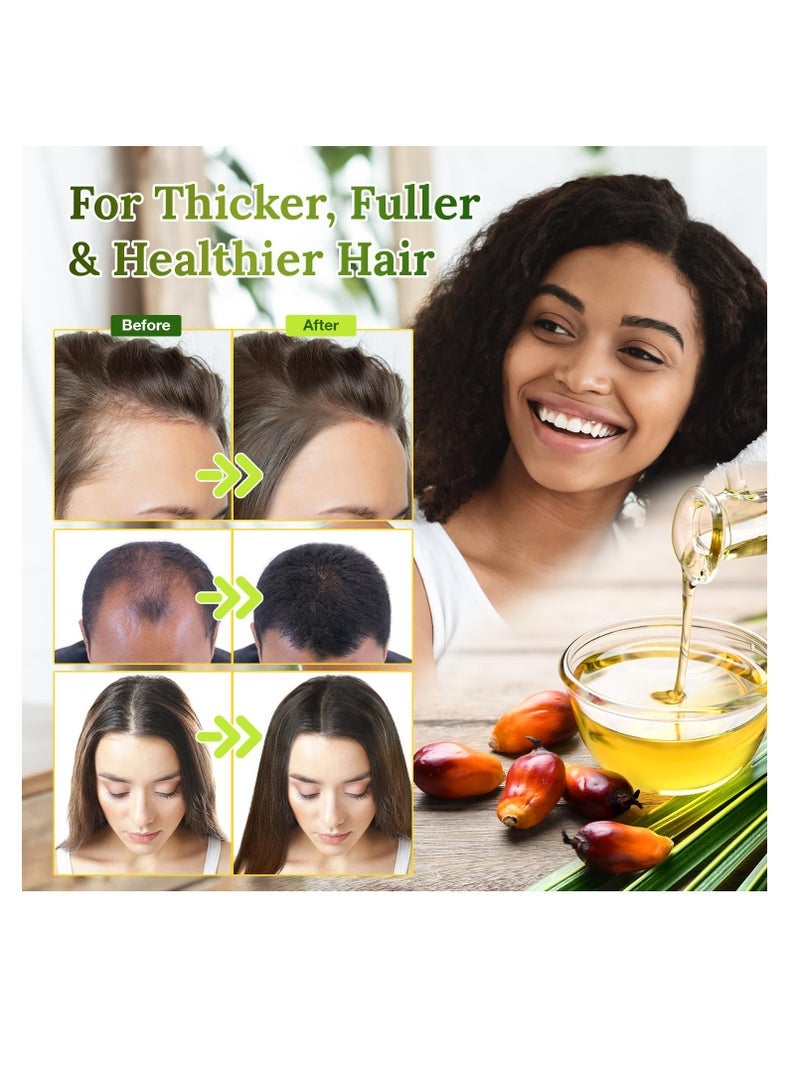 YBW 100% Natural, Unrefined and Organic Batana Oil from Honduras for Hair Growth - Enhances Hair Thickness, Prevents Loss for Men & Women - Image 3