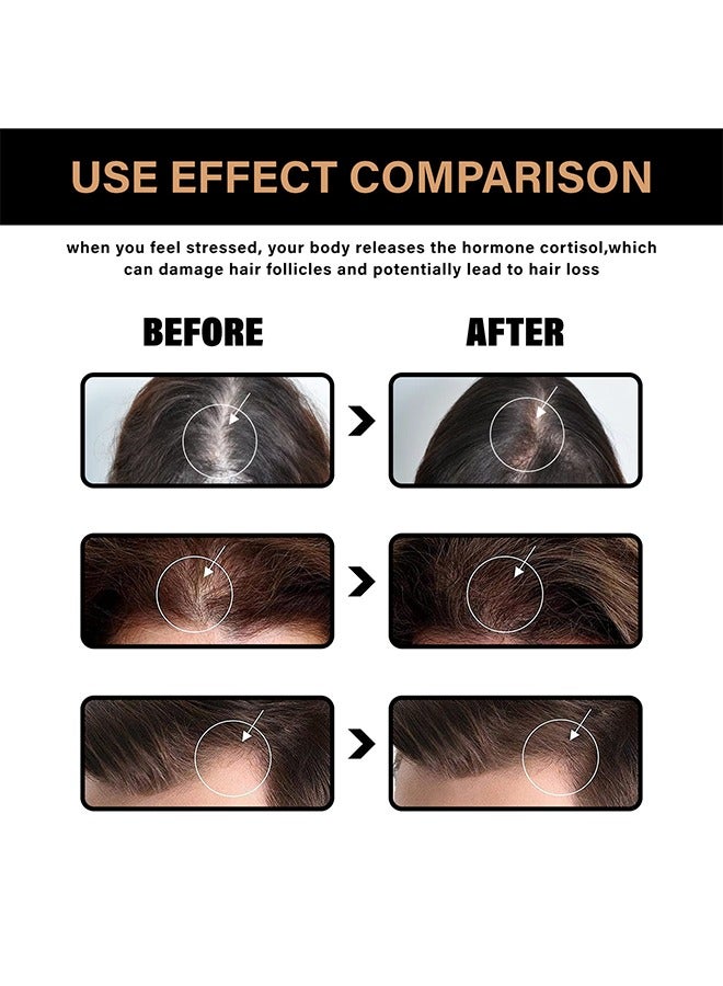 LUNOON Root Activator Shampoo,Anti-Thinning Shampoo, Hair Regrowth, Hair Thickening, Deep Moisturizing, Natural Formula Shampoo for Dry Damaged Weak and Thin Hair Care 100ml - Image 4