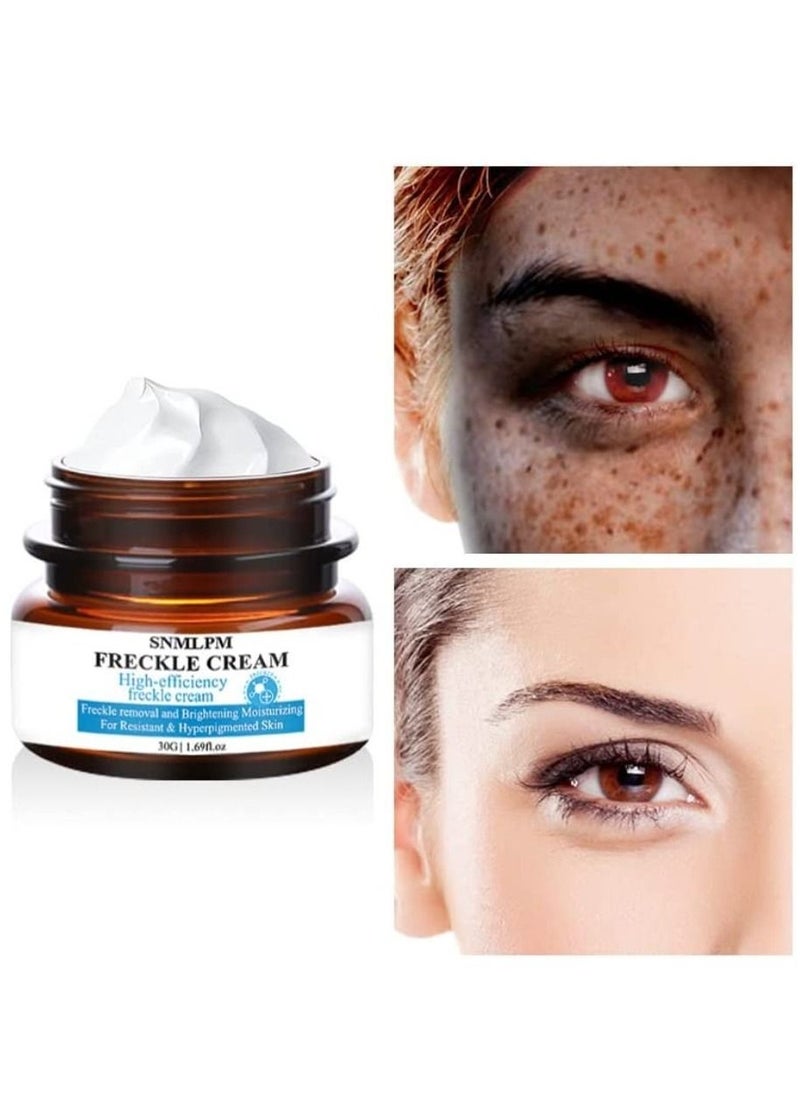 SNMLPM - High Efficiency Freckle Cream Freckle Remover Brightening Deep Moisturizing Dark Spot Corrector Melasma Cream For Men & Women 30g - Image 1