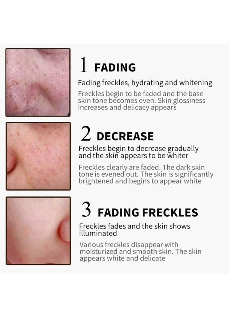 SNMLPM - High Efficiency Freckle Cream Freckle Remover Brightening Deep Moisturizing Dark Spot Corrector Melasma Cream For Men & Women 30g - Image 1