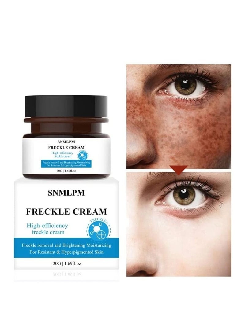 SNMLPM - High Efficiency Freckle Cream Freckle Remover Brightening Deep Moisturizing Dark Spot Corrector Melasma Cream For Men & Women 30g - Image 1