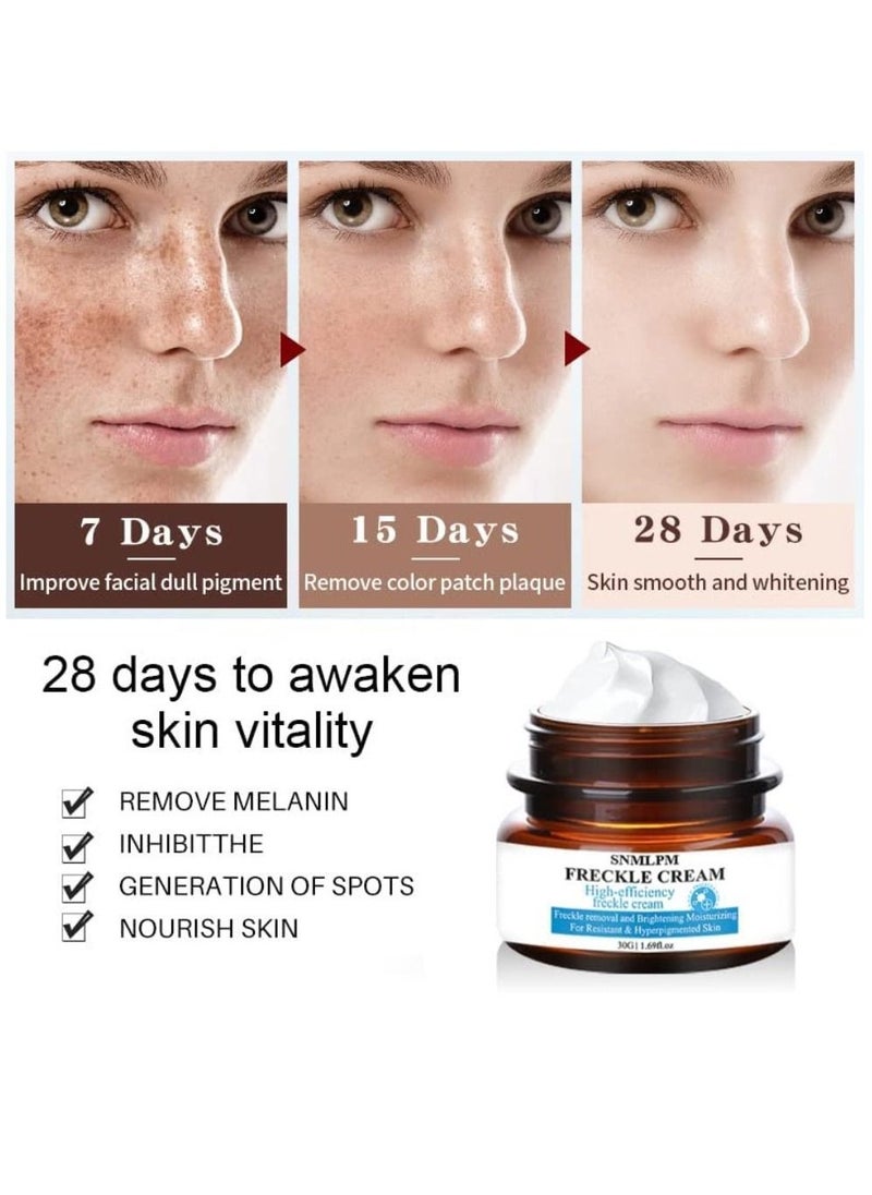 SNMLPM - High Efficiency Freckle Cream Freckle Remover Brightening Deep Moisturizing Dark Spot Corrector Melasma Cream For Men & Women 30g - Image 1