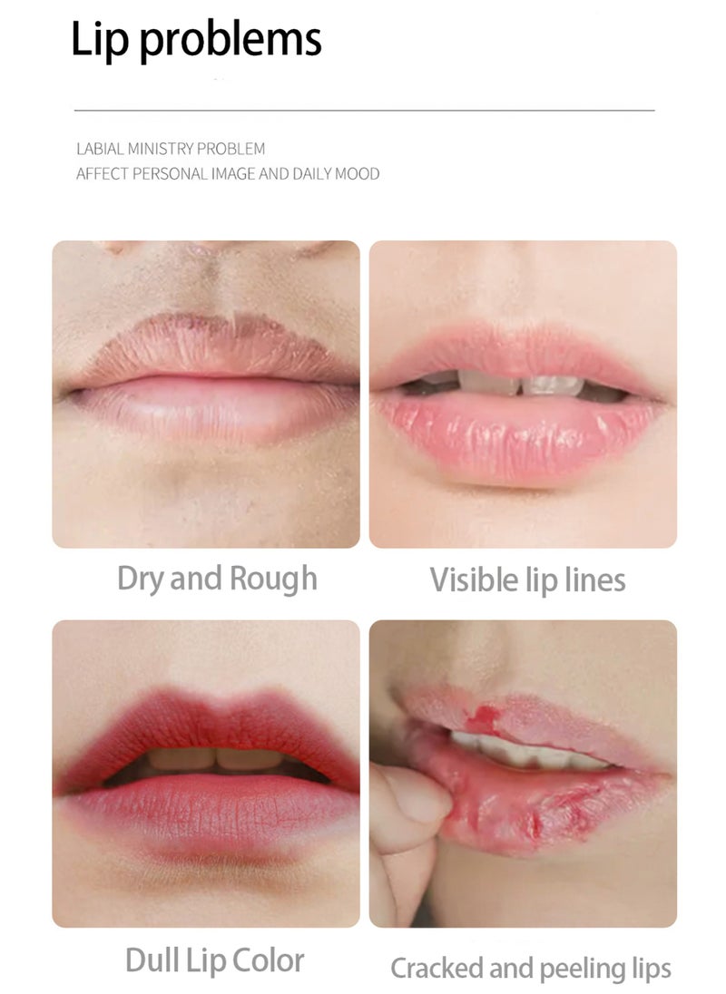 ZHIDUO - 20Pcs Fascinating Cherry Nourishing And Smoothing Lip Mask, 60g - Image 1