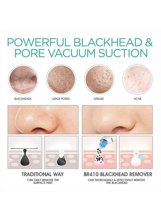 VOYOR - Blackhead Remover Pore Vacuum - Electric Face Vacuum Pore Cleaner Acne White Heads Removal with 6 Suction Head BR410 - Image 1