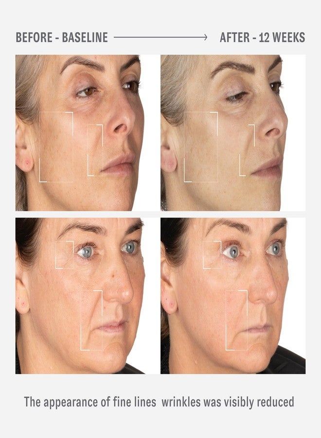 O HUI Reverse Activator Retinol Fine Wrinkle Cream | Korean Skin Care | Comfortable Retinol Cream for Face | Minimal to no irritation | Peptide | Wrinkles Visibly Reduced by 42% in 8 Weeks - Image 5