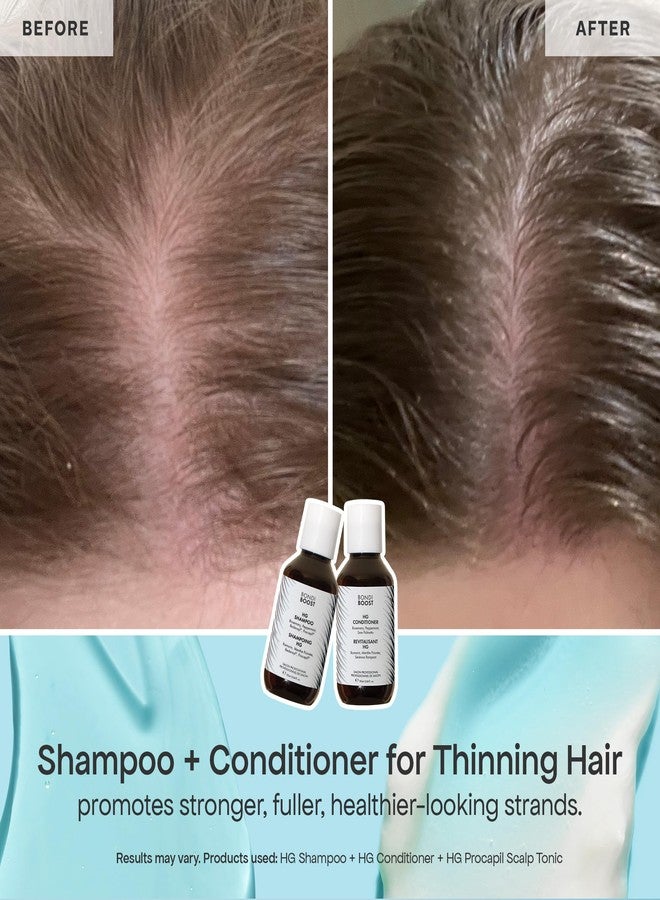 BondiBoost Shed Happens Anti-Thinning Hair Trio – HG Shampoo + Conditioner (90ML) + Lock Drops Serum (30ML) – Reduces Shedding, Supports Fuller & Thicker-Looking Hair – Vegan, Sulfate & Paraben Free - Image 4