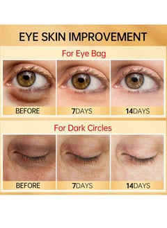 JoyPretty Retinol Anti Wrinkle Eye Cream Remove Eye Bags Puffiness Dark Circles Whitening Moisturizing Eyes Skin Care Remove Eye Bag Anti Puffiness Dark Circles Eye Gel Retinol Eye Serum 25g  - Image 4