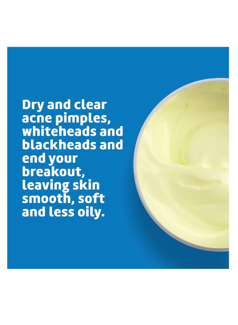 De La Cruz Sulfur Ointment - Cystic Acne Treatment - Cystic Acne Spot Treatment for Face and Body - 2.6 OZ  - Image 4