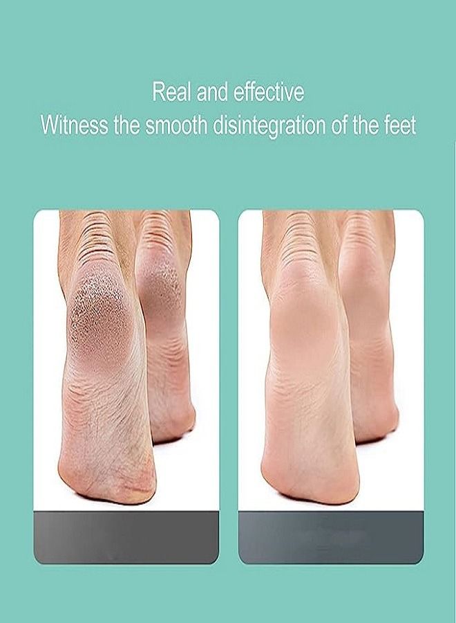إزالة callus الكهربائية للقدمين قابلة لإعادة الشحن عبر USB أداة قدم إلكترونية محمولة، أدوات باديكير، أدوات العناية بالقدم لإزالة callus للجلد الميت المتشقق الصلب - Image 3