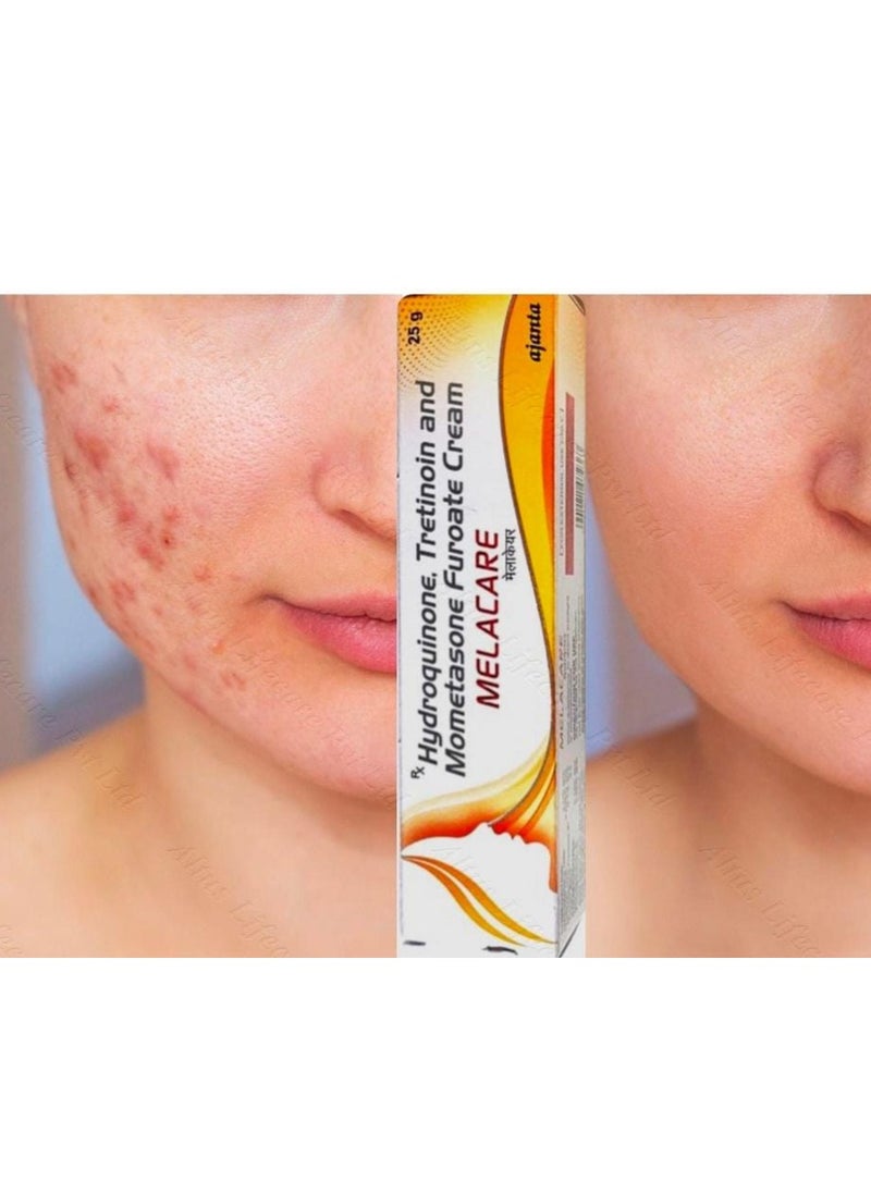 Generic - olivecart com ajanta melacare hydrogenone tretinoin and mometasone furoate cream - Image 1