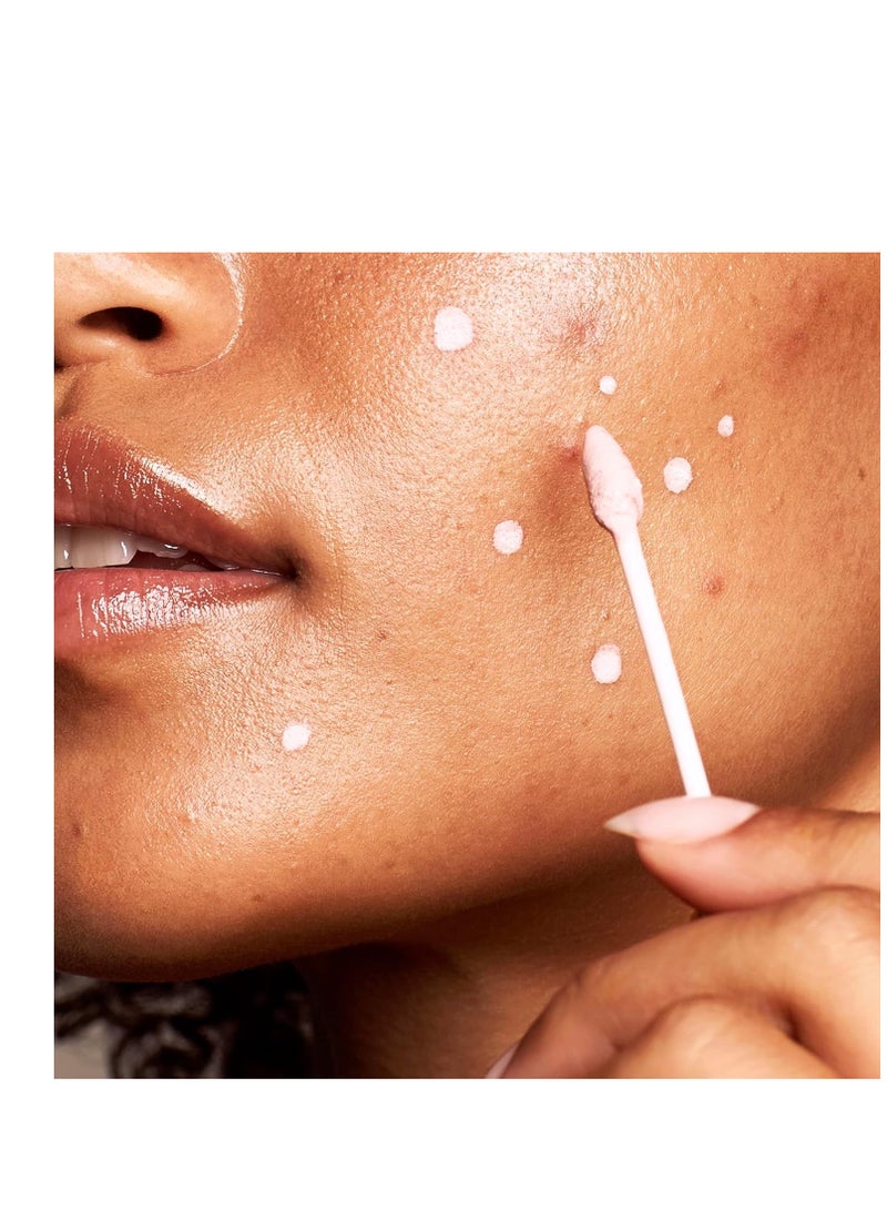 Kate Somerville علاج حب الشباب إيراديكيت من كيت سومرفيل - علاج موضعي بتركيبة سريرية تحتوي على 10% كبريت وحمض BHA - يزيل البثور، ينظف المسام ويمنع ظهور الحبوب، 1 أونصة سائلة