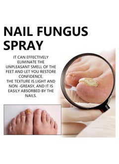CMGTYYD Fungal Spray, Fungal Nail Treatment, Advanced Foot and Nail Spray, Toenail Fungus Treatment, Toenail Fungus Treatment and Nail Strengthener, Restore Healthy Nails (100ml)  - Image 3