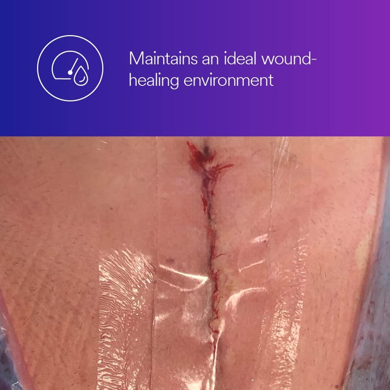 3M ضمادة أكريليك شفافة ماصة 3M تيغاديرم 90800 بيضاوي 3 بوصة × 334 بوصة 76 سم × 95 سم 10CAR 4 CARCS - Image 2