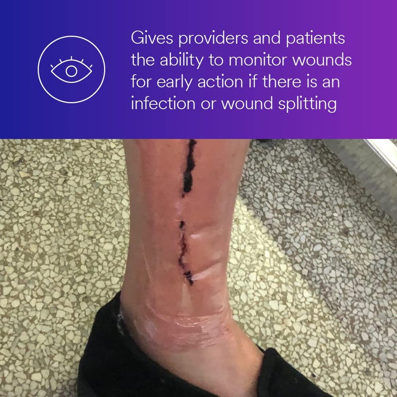 3M ضمادة أكريليك شفافة ماصة 3M تيغاديرم 90800 بيضاوي 3 بوصة × 334 بوصة 76 سم × 95 سم 10CAR 4 CARCS - Image 5