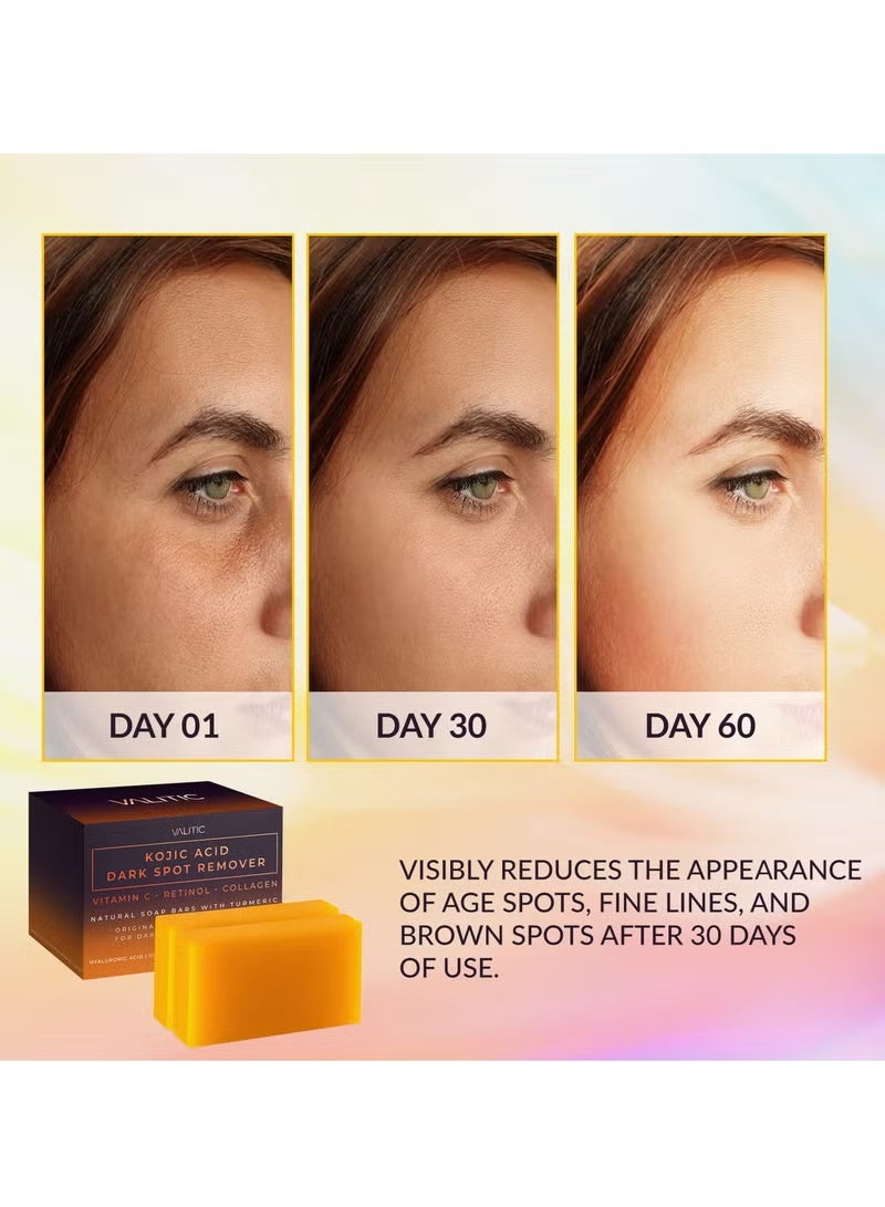 فاليتيك صابون لإزالة البقع الداكنة بحمض الكوجيك مع فيتامين سي، والريتينول، والكولاجين، والكركم - مركب ياباني أصلي غني بحمض الهيالورونيك، وفيتامين هـ، وزبدة الشيا، وزيت الزيتون القشتالي - Image 3