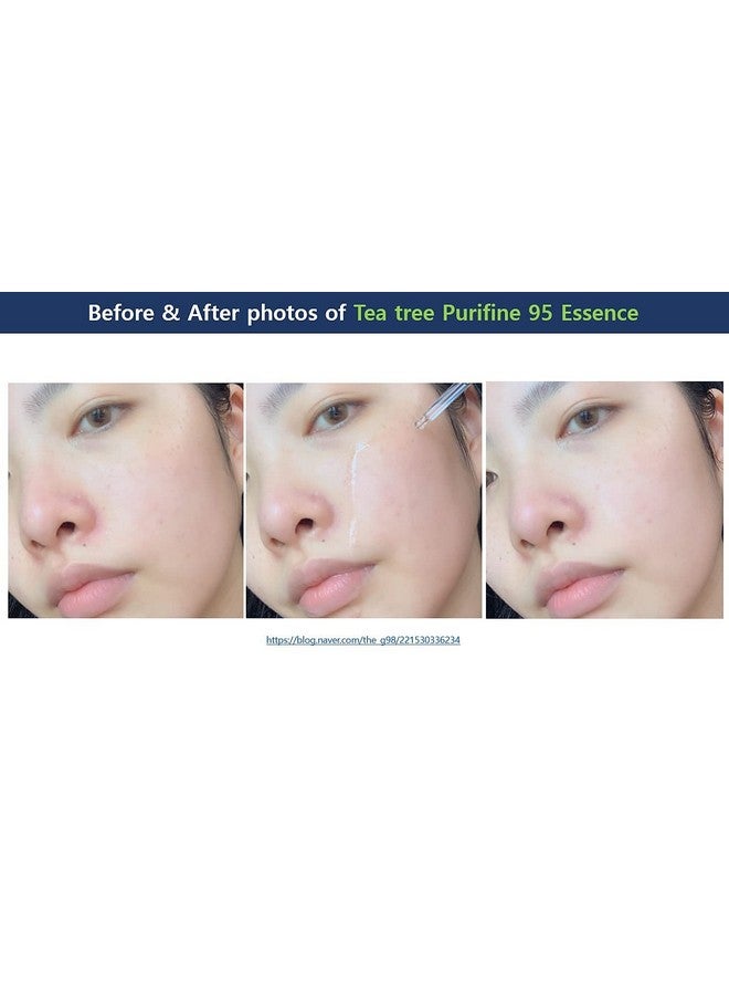 leegeehaam Dr.Ceuracle () Tea Tree Purifine 95 Essence 50Ml 1.69 Fl. Oz. - Image 3