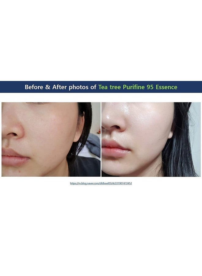 leegeehaam Dr.Ceuracle () Tea Tree Purifine 95 Essence 50Ml 1.69 Fl. Oz. - Image 4